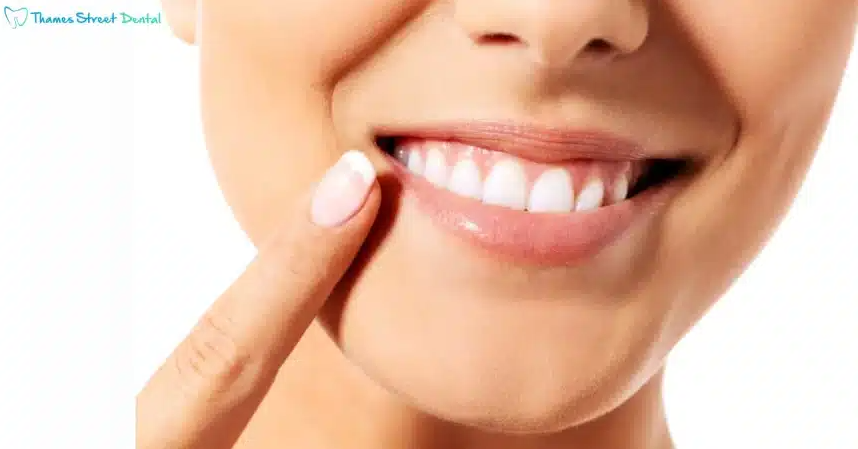 Thames Street Dental