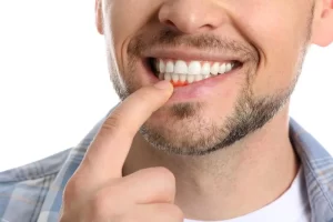 sore-gums-male