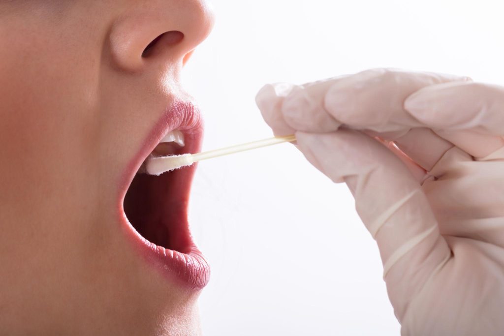 Saliva spit test at the dentist