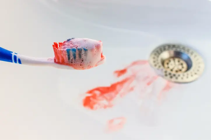 Do your gums bleed when you brush your teeth?