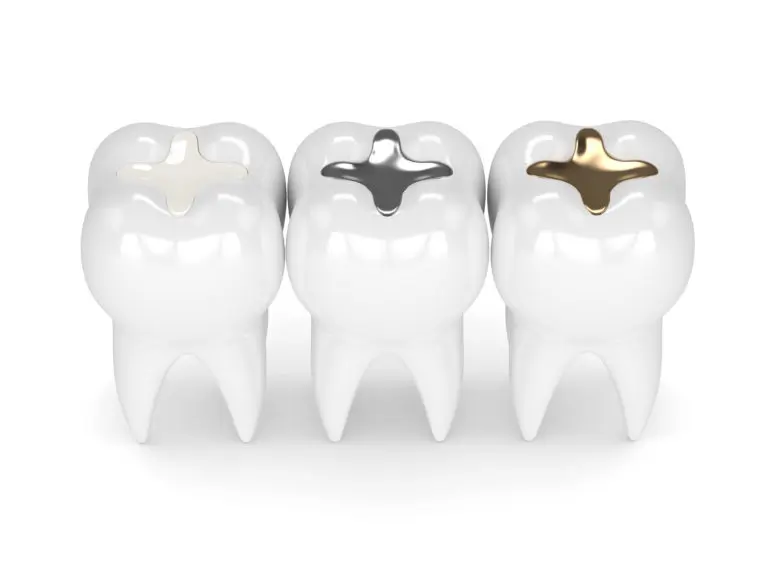 Fillings: Silver Fillings vs White Fillings