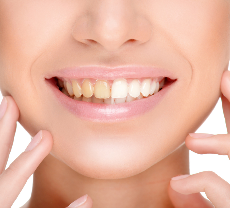 Cosmetic Dentist Kingston upon Thames